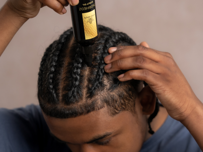 TndrHedz Hair Scalp Oil - Image 4